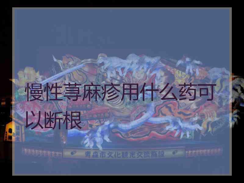 慢性荨麻疹用什么药可以断根