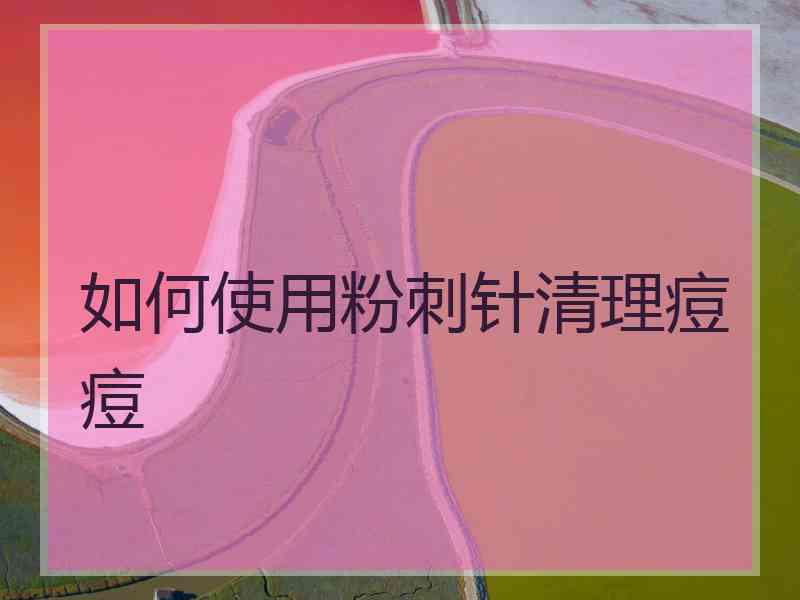 如何使用粉刺针清理痘痘