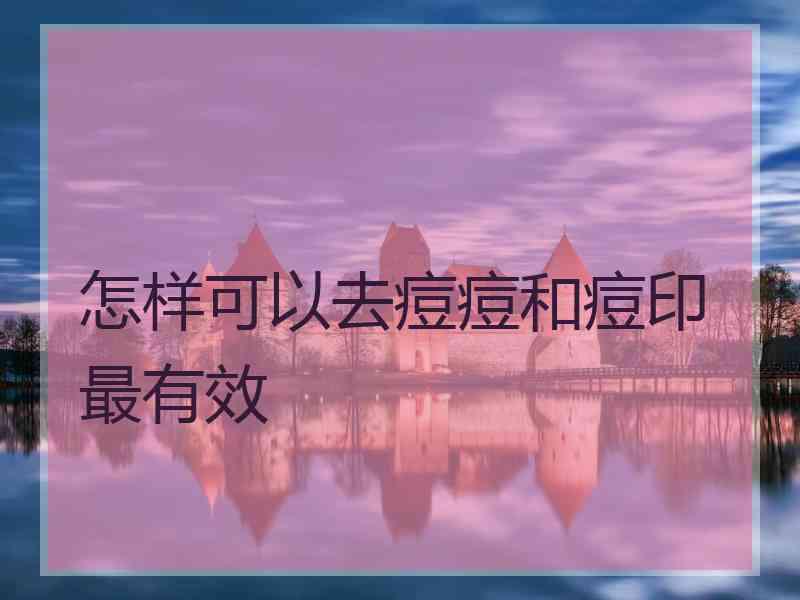 怎样可以去痘痘和痘印最有效