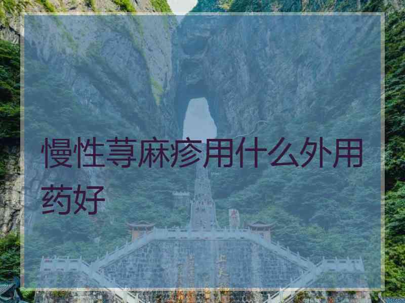 慢性荨麻疹用什么外用药好